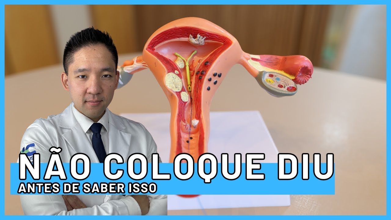 N&atilde;o coloque o DIU ( Dispositivo Intra Uterino) antes de saber isso!