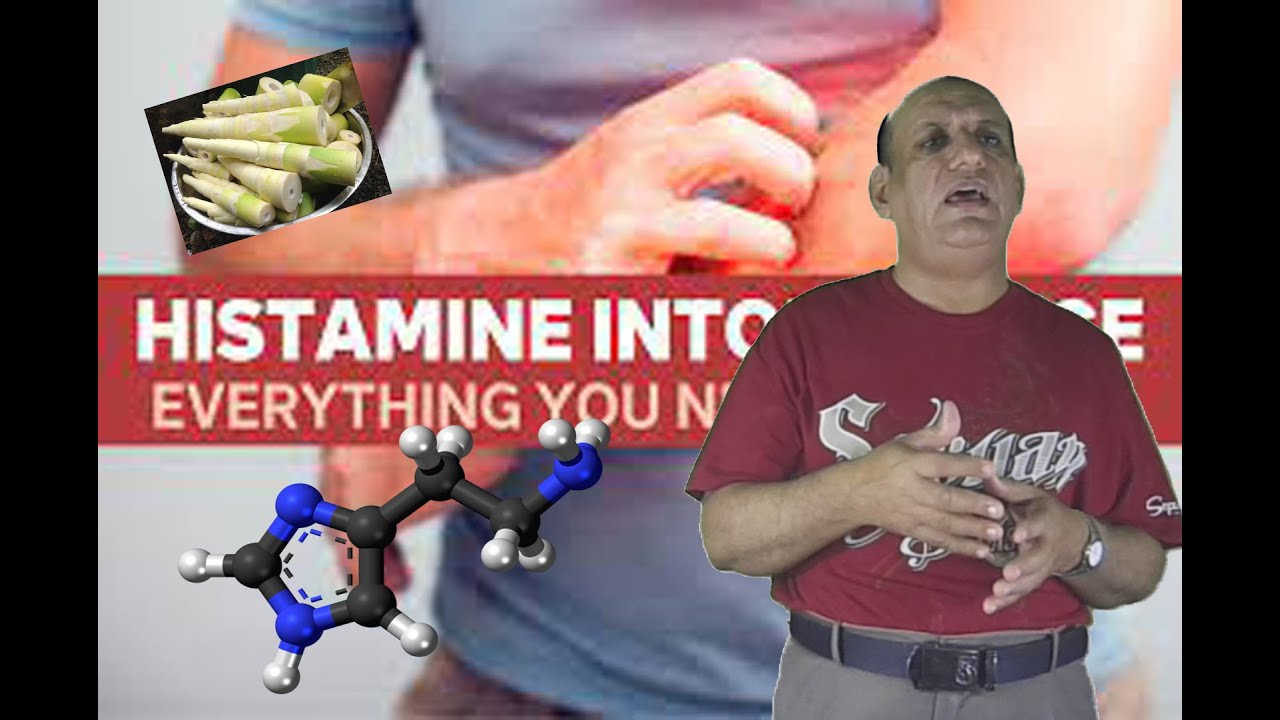 عدم تحمل الهيستامين Histamine intolerance