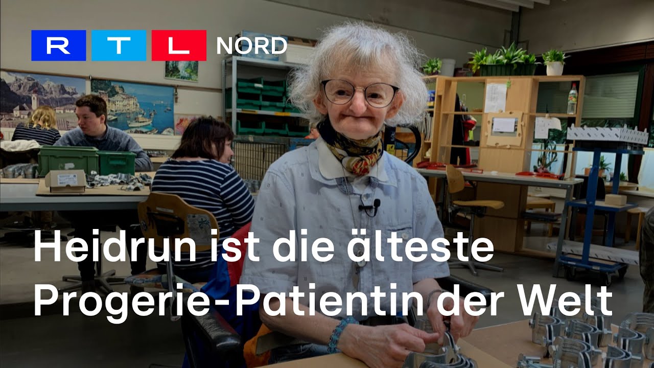 Progerie-Patientin Heidrun ist ein medizinisches Wunder