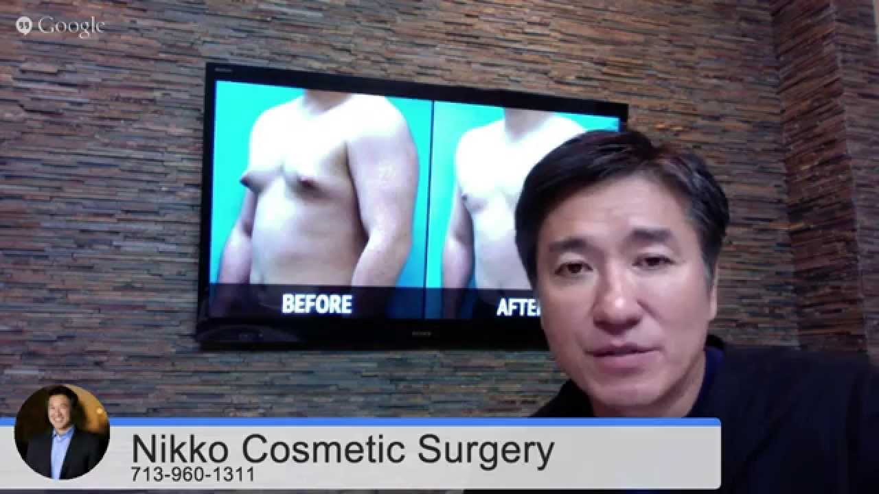 Male Breast Reduction Houston- Dr. Nikko Answers Gynecomastia Questions