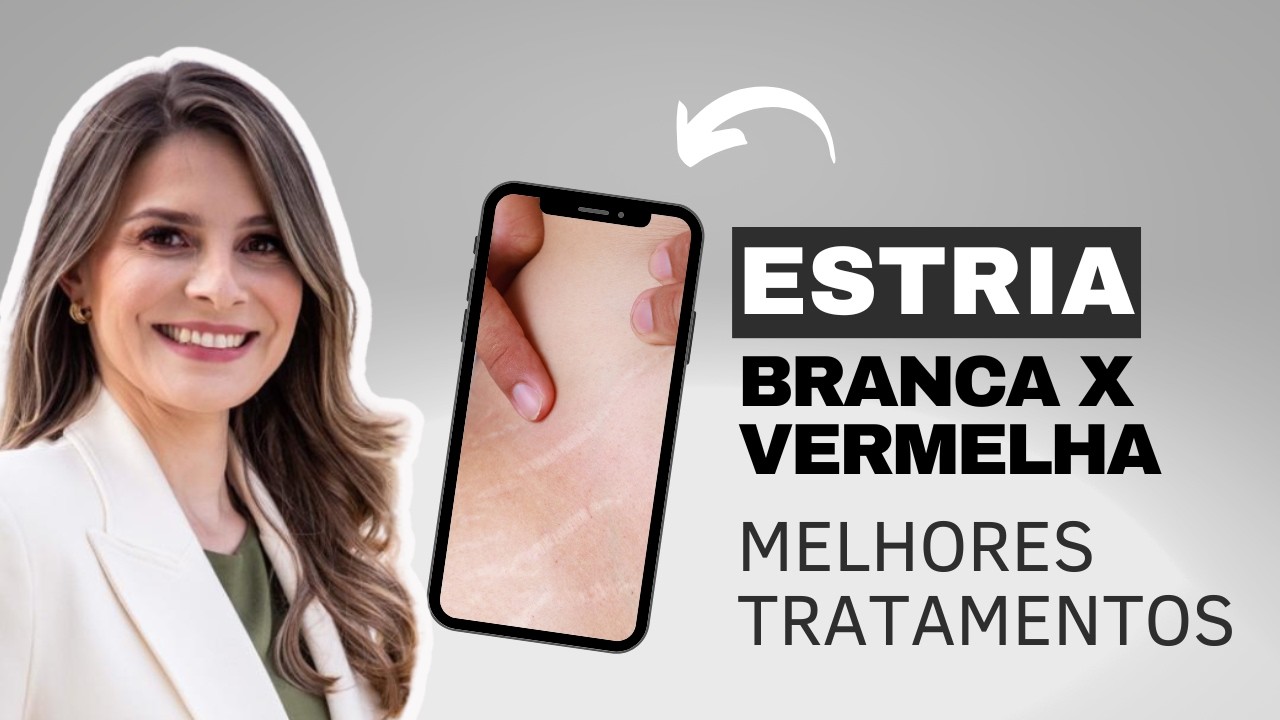 TRATAMENTOS PARA ESTRIAS VERMELHAS E BRANCAS - DERMATO DRA LAILA
