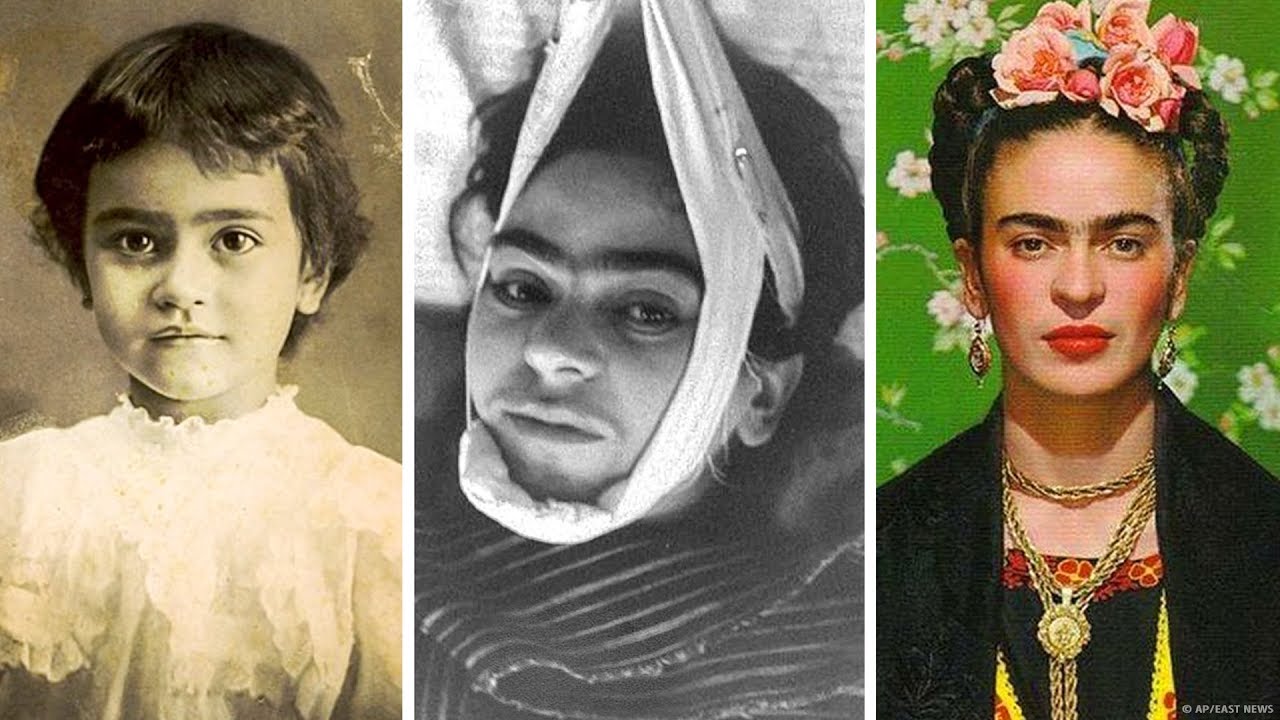 Frida Kahlo&rsquo;nun Trajik Hikayesi