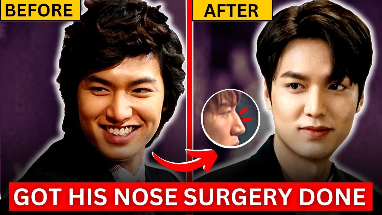 Korean Celebrities Who Secretly Got Plastic Surgery