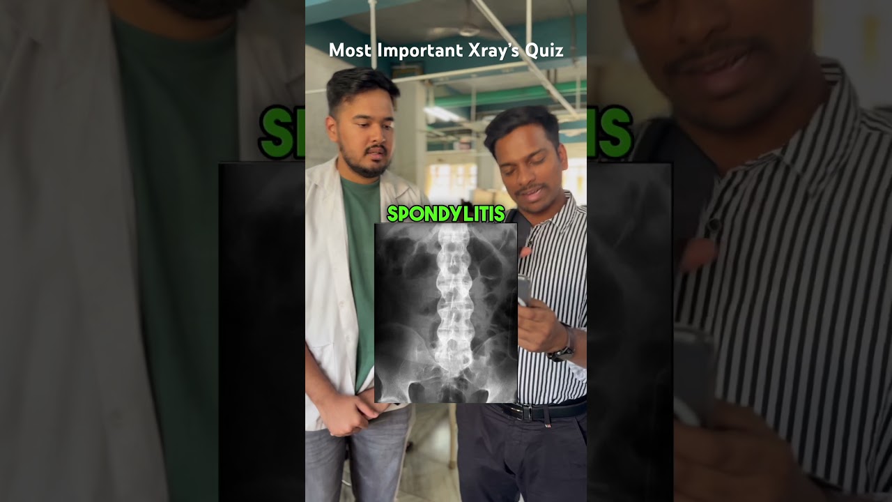 Most Important Xray&rsquo;s Quiz #x-ray #medicalquiz #medicine #mbbs #neetpg #usmle
