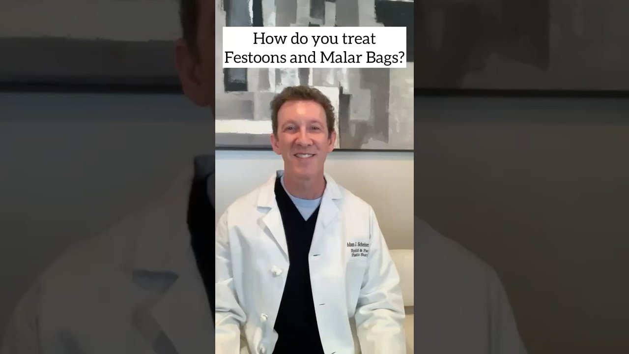 How do you treat Festoons and Malar Bags? #festoons#malarbags