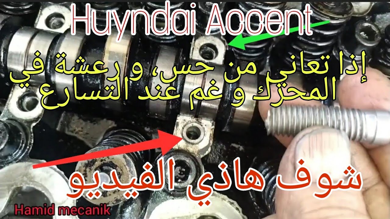 التخلص نهائيا من حس، رجفة في المحرك و غم و عدم العزم  Huyndai Accent 1.5 بنزين