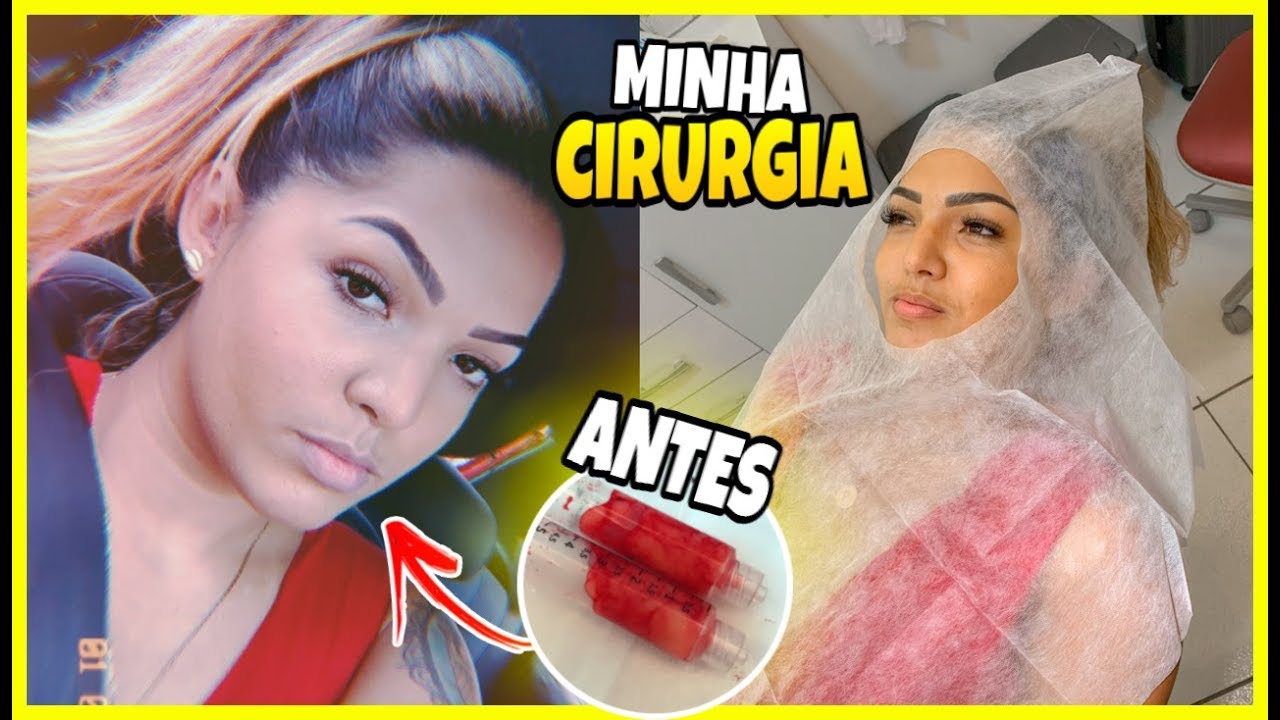 VLOG - MINHA PRIMEIRA CIRURGIA PLÁSTICA + GRAVEI TUDO!!!