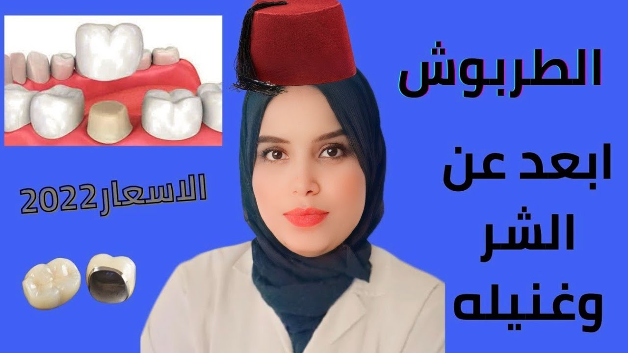 نصائح بعد حشو العصب وتعليمات بعد تركيب الطربوش الثابت لا يقولها لك طبيب الاسنان