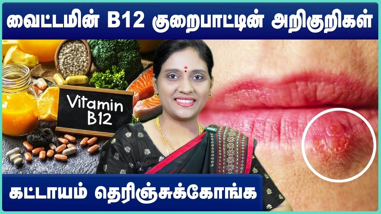 வைட்டமின் பி12 அதிகம் நிறைந்த உணவுகள் | vitamin b12 deficiency symptoms in tamil | Cosmo Health 