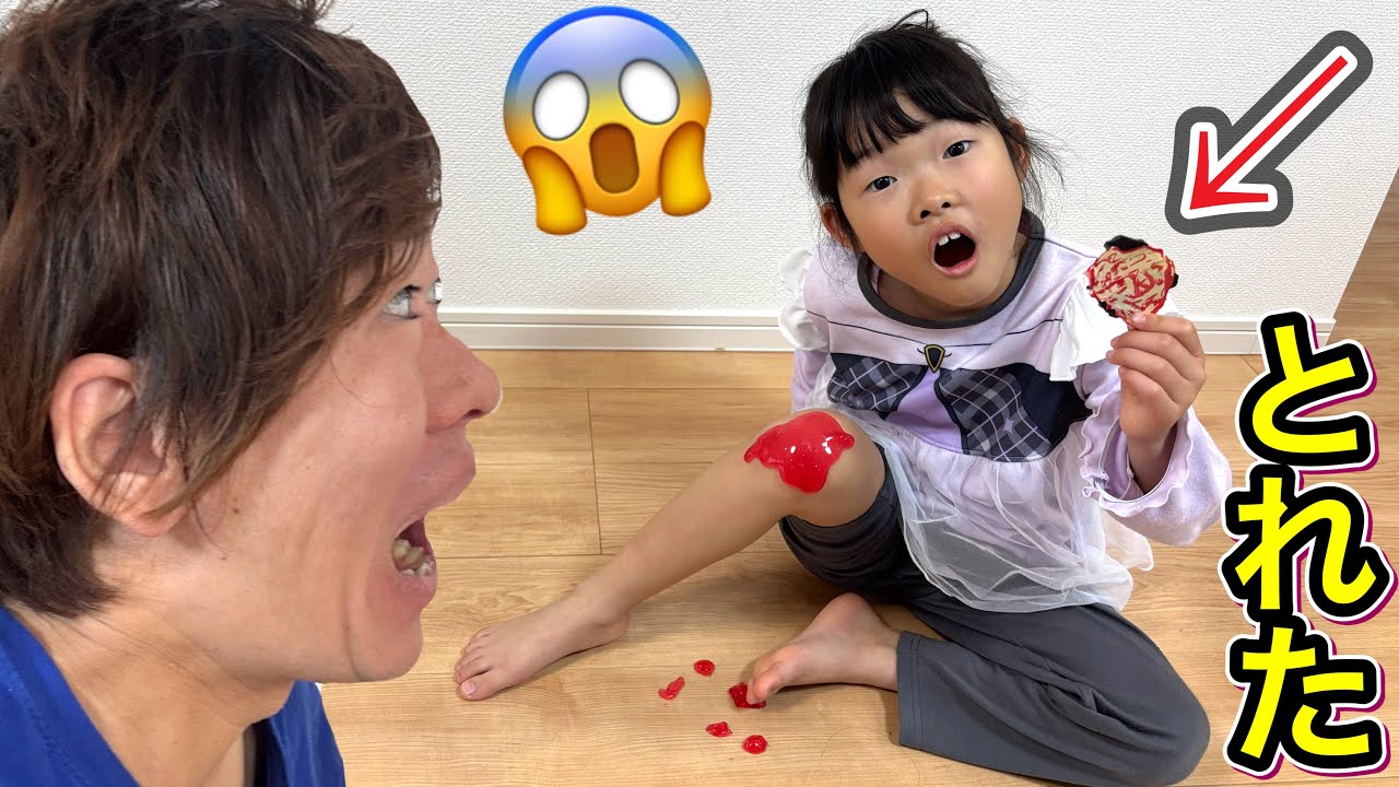 かさぶた取れたよ…気になったここちゃんが取ってしまいました・・・・・😱【実話再現】