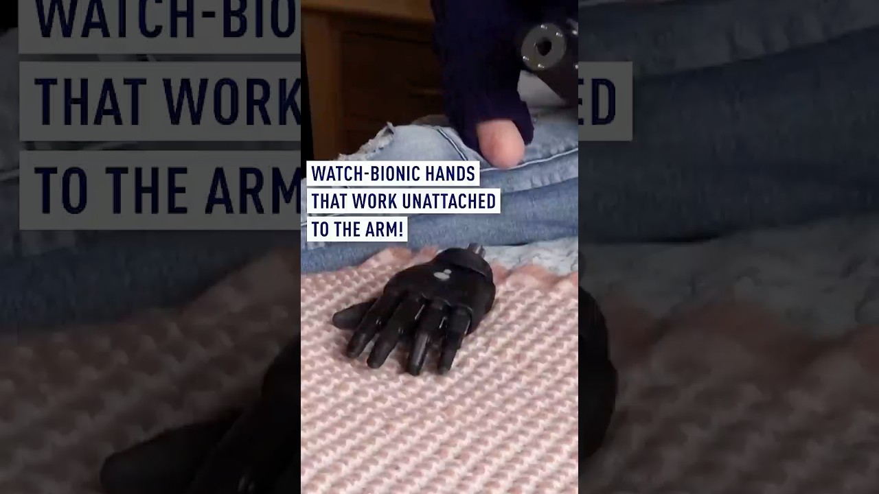 Bionic hands that work unattached to the arm