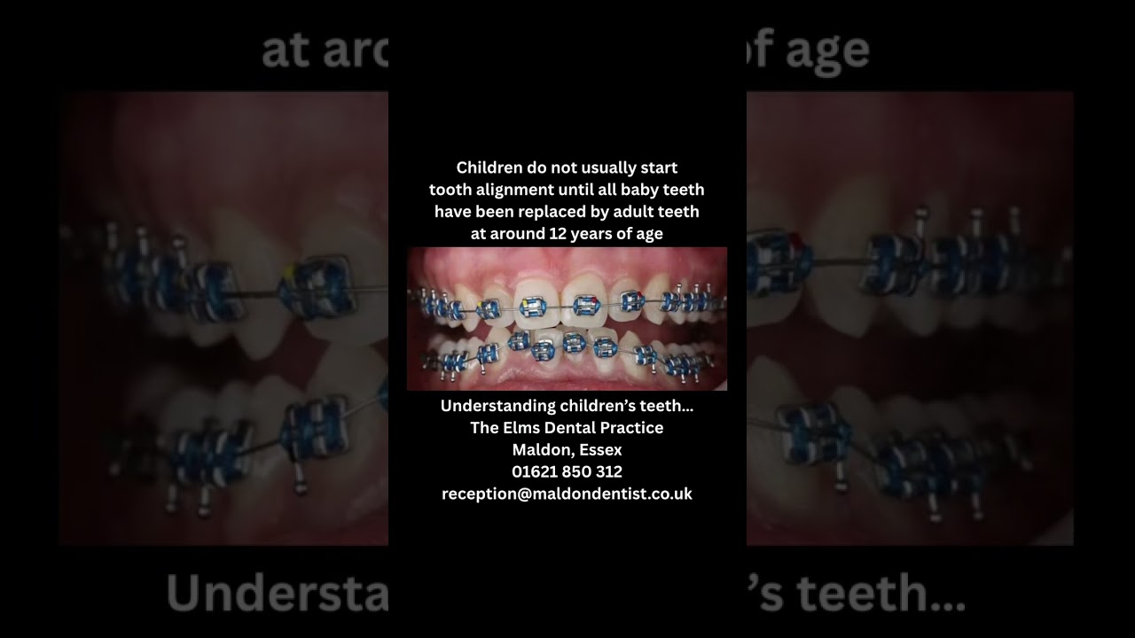 Braces