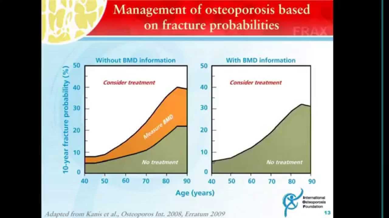 FRAX como herramienta de evaluación de riesgo de fractura - Dr. Konstantinos Tserotas