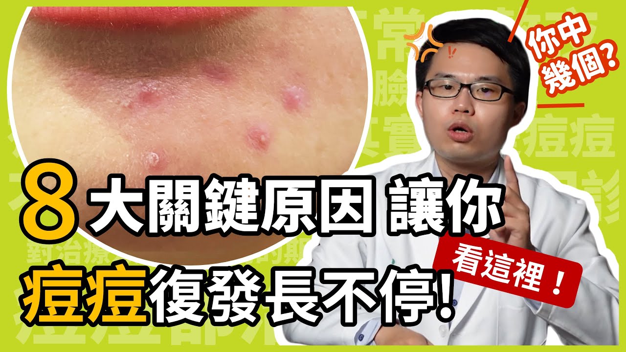 8大關鍵原因，讓你痘痘復發長不停！皮膚科楊省三醫師點出青春痘的治療重點！