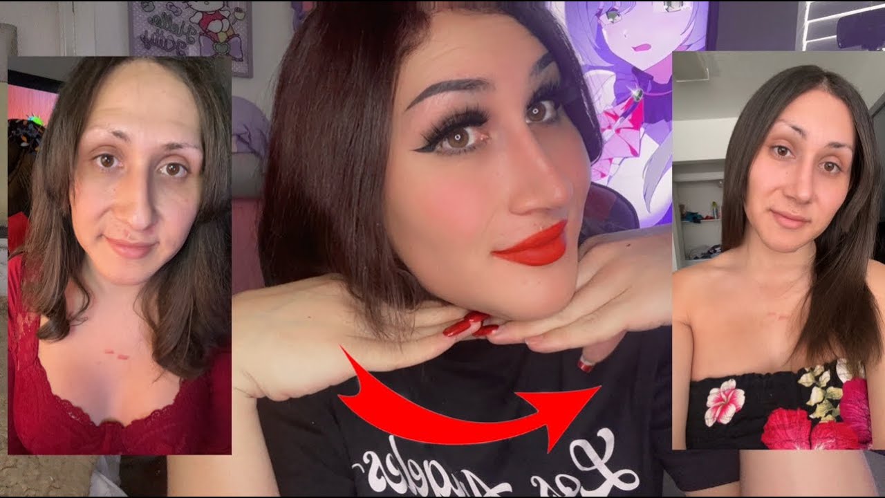 Facial Feminization Surgery: The Goods and Bads