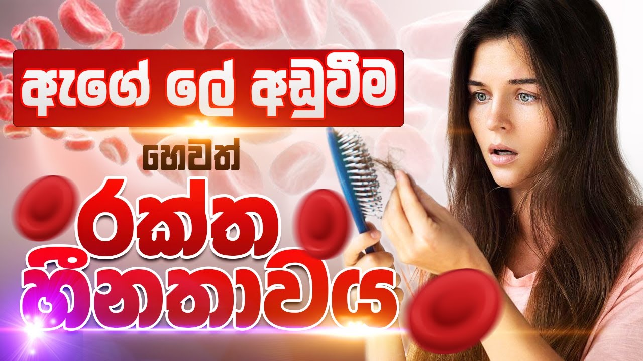 ඇගේ ලේ අඩුවීම | රක්තහීනතාවයට හේතු සහ ප්‍රතිකාර | Anemia Sinhala