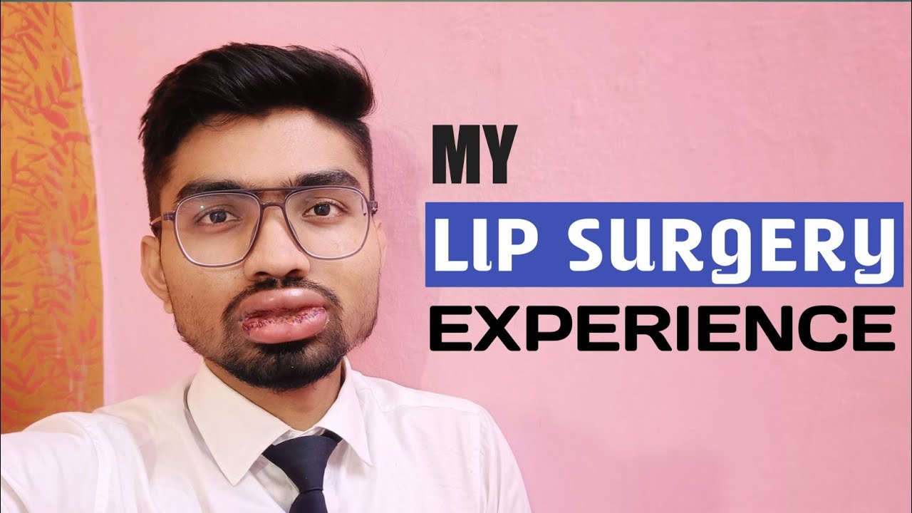 My Lip Surgery Experience | Cosmetic surgery