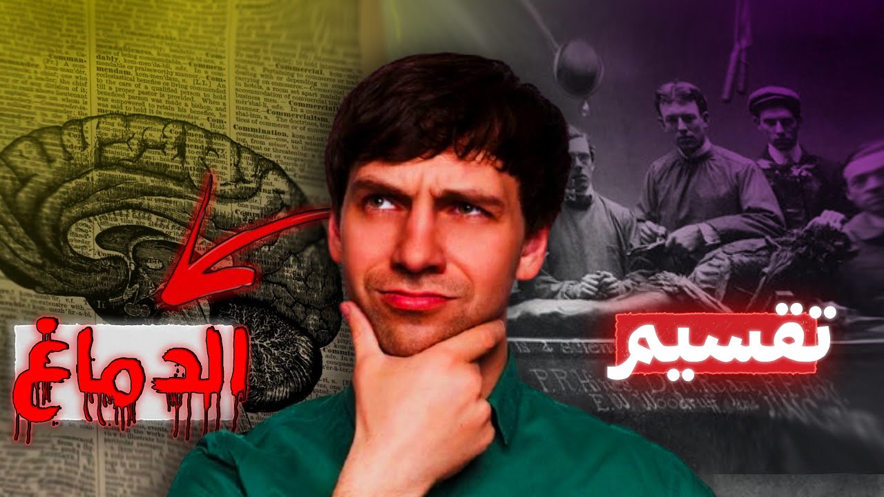 اغرب تجربة | فصلوا دماغ الإنسان لنصفين… وهنا بدأت الكارثة