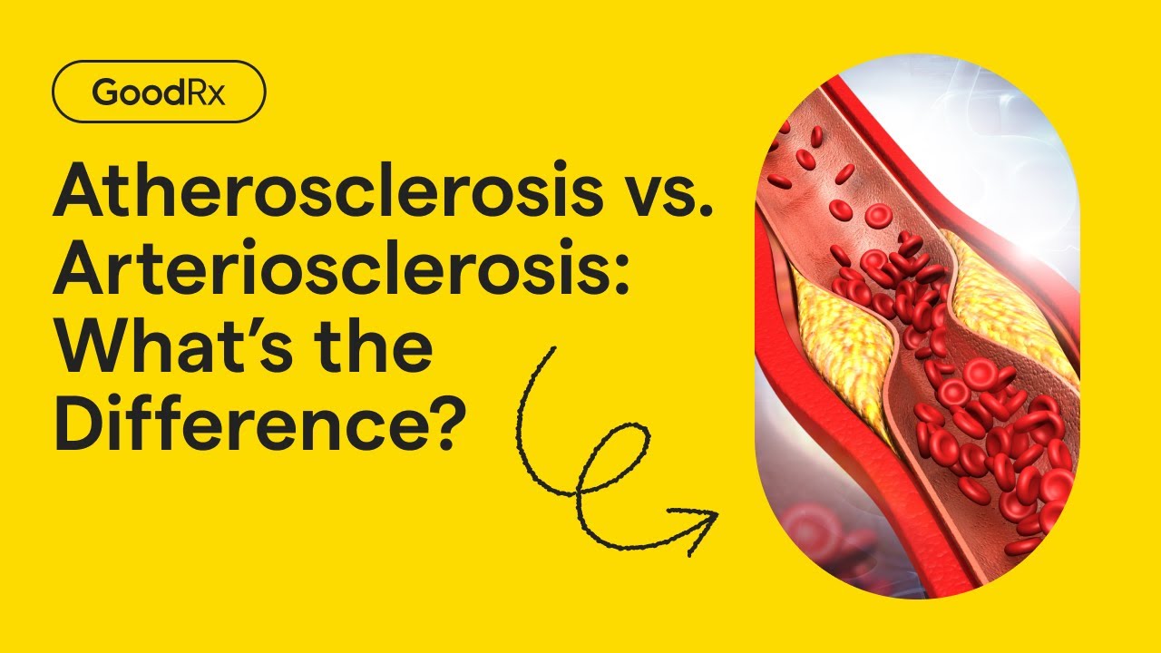Atherosclerosis vs. Arteriosclerosis: What&rsquo;s the Difference? | GoodRx