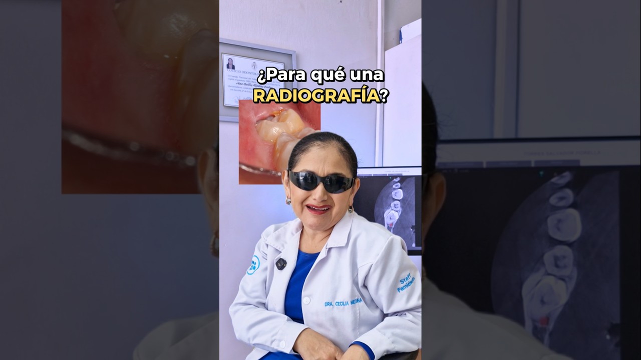 ¿Necesito una radiografía dental? 