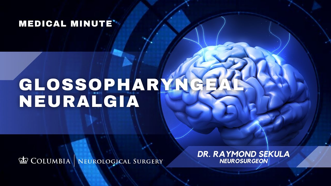 Glossopharyngeal Neuralgia: Neurosurgeon, Raymond F. Sekula, Jr., MD