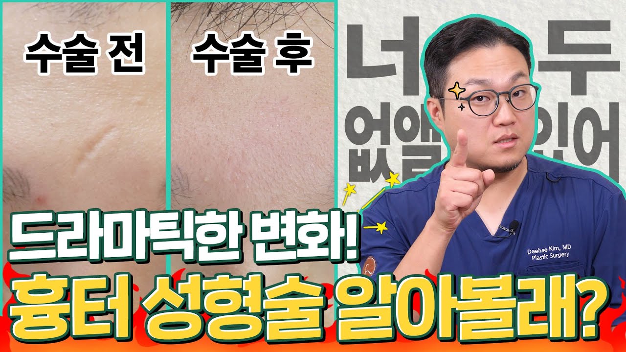 드라마틱한 변화! 흉터 성형술 알아볼래?