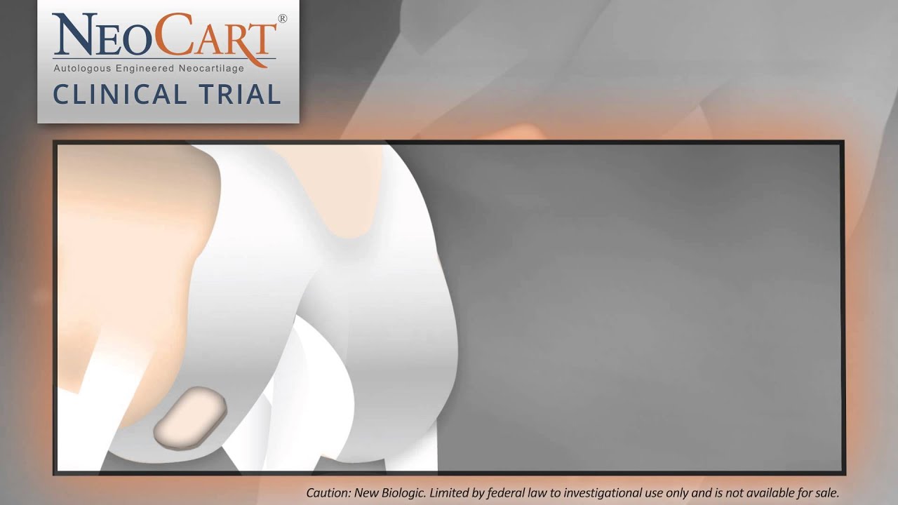 Learn About the NeoCart&reg; Clinical Trial