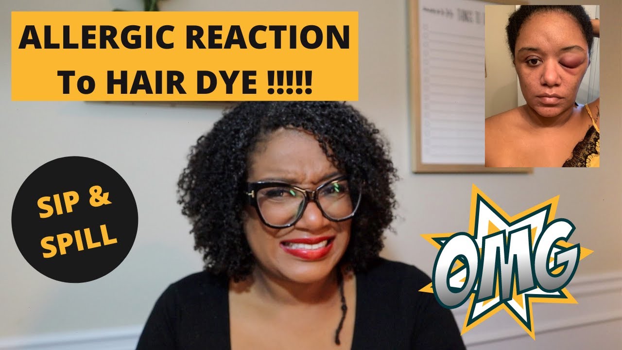 Allergic Reaction to HAIR DYE that happened..... TWICE! My first Sip & Spill