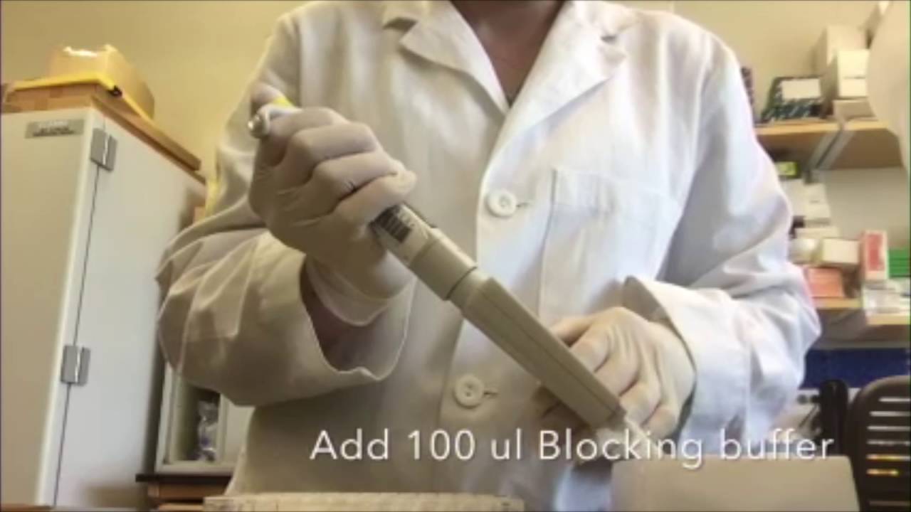 Indirect Elisa (2016)