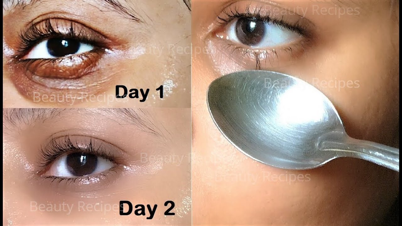 How to Remove Under Eye WRINKLES, Under Eye Bags, Puffy eyes & Dark Circles in 1 Day with ice cubes