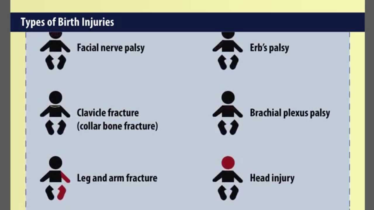 Birth Injury Lawyer | Cerebral Palsy Attorney | The Rothenberg Law Firm LLP