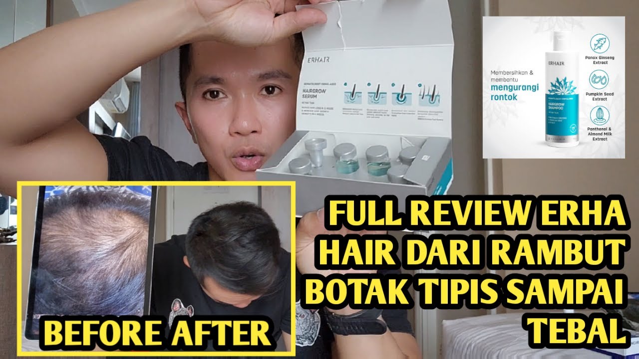 FULL REVIEW JUJUR ERHA HAIR UNTUK RAMBUT BOTAK TIPIS RONTOK SAMPAI TEBAL WAJIB TONTON!