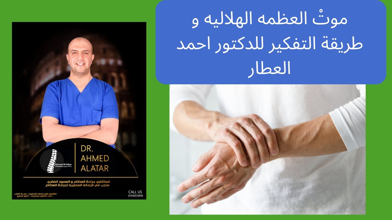 المْ الرسغ (موت العظمه الهلاليه) للدكتور احمد العطار