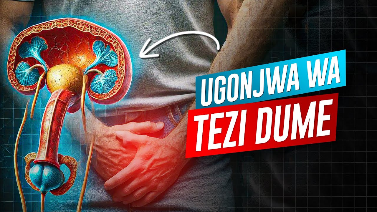 Dalili za Tezi Dume. Matibabu na Elimu ya Ugonjwa wa Tezi Dume PBH.!