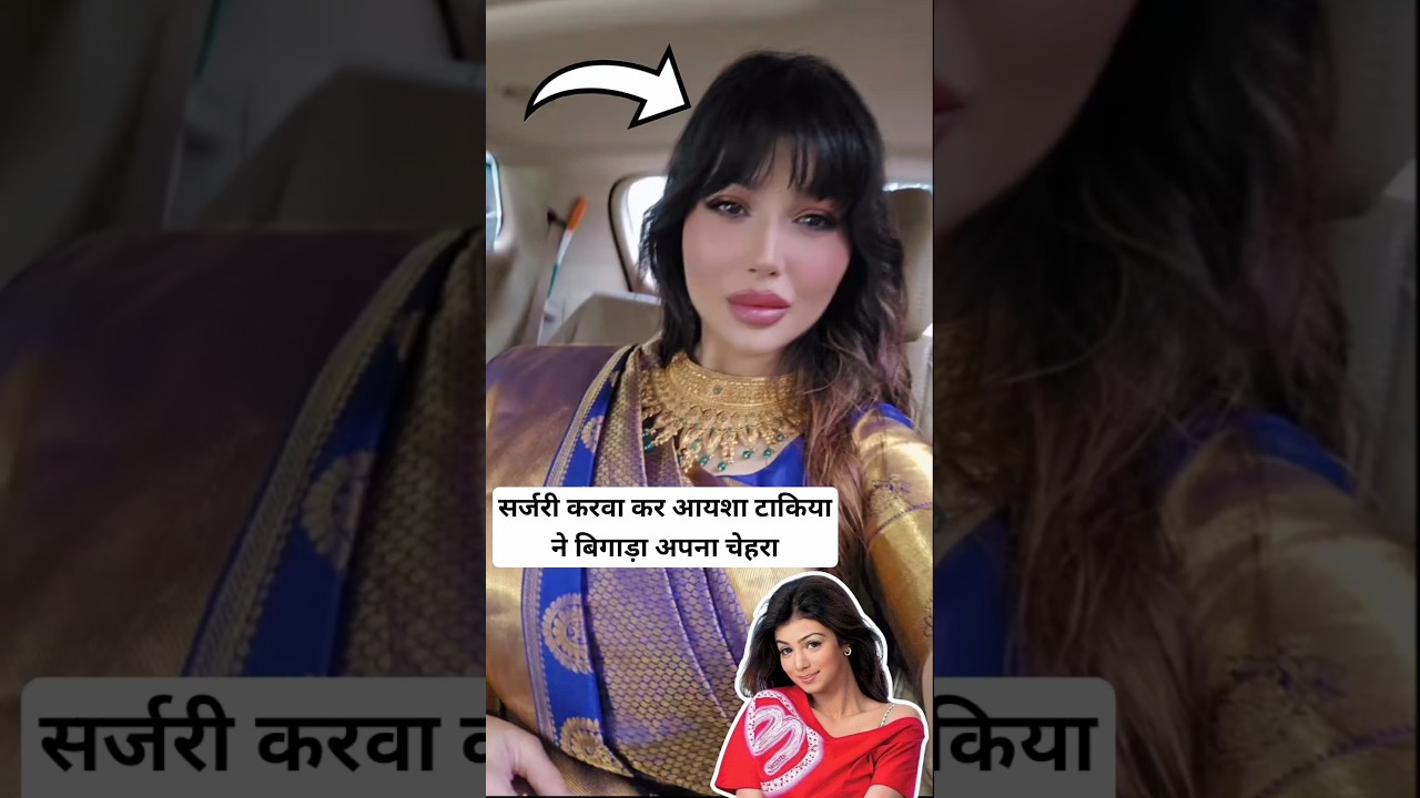 Ayesha Takia ruined her face by undergoing surgery #ayesha #bollywood