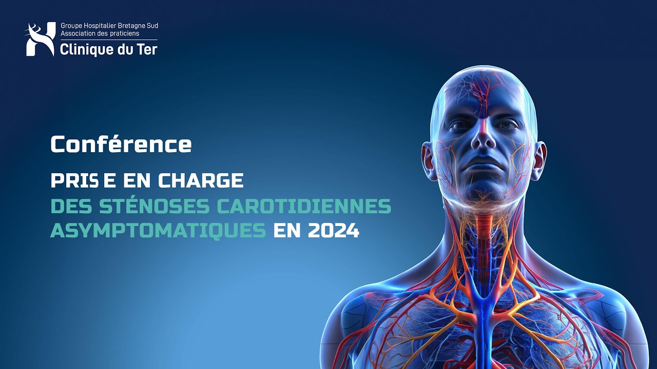 Conférence : Prise en charge des sténoses carotidiennes asymptomatiques en 2024