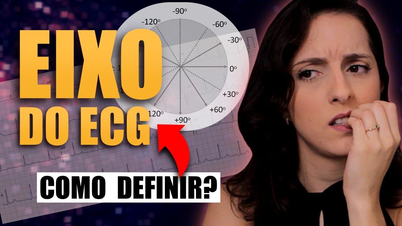 Como Calcular o Eixo do ECG (SIMPLES e PRÁTICO!)