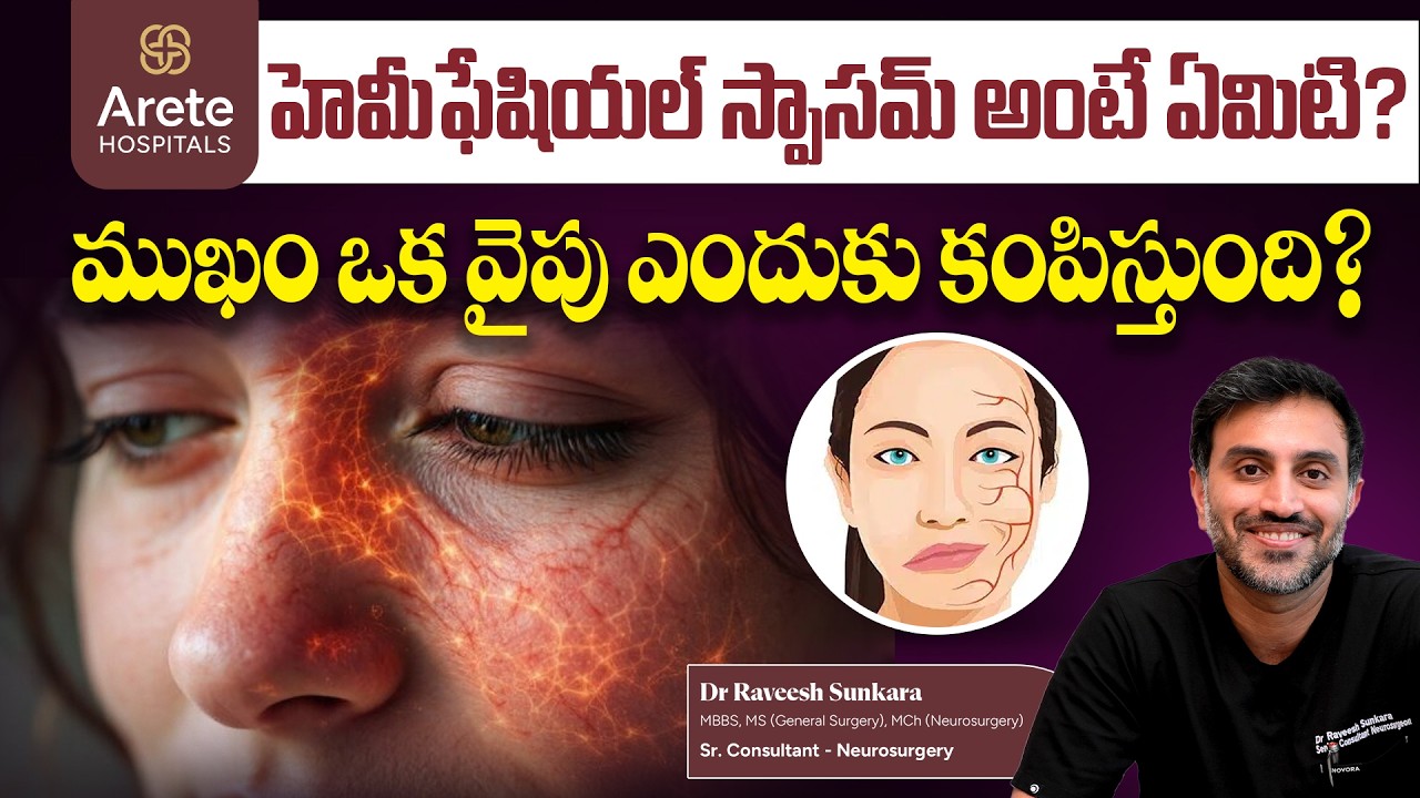 Hemifacial Spasms - Causes, Symptoms, Diagnosis, and Treatment