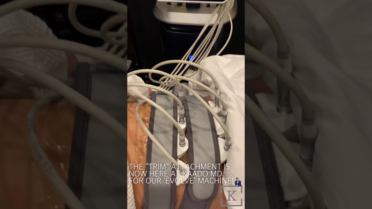 EVOLVE: &ldquo;TRIM&rdquo; ATTACHMENT - KAADO MD