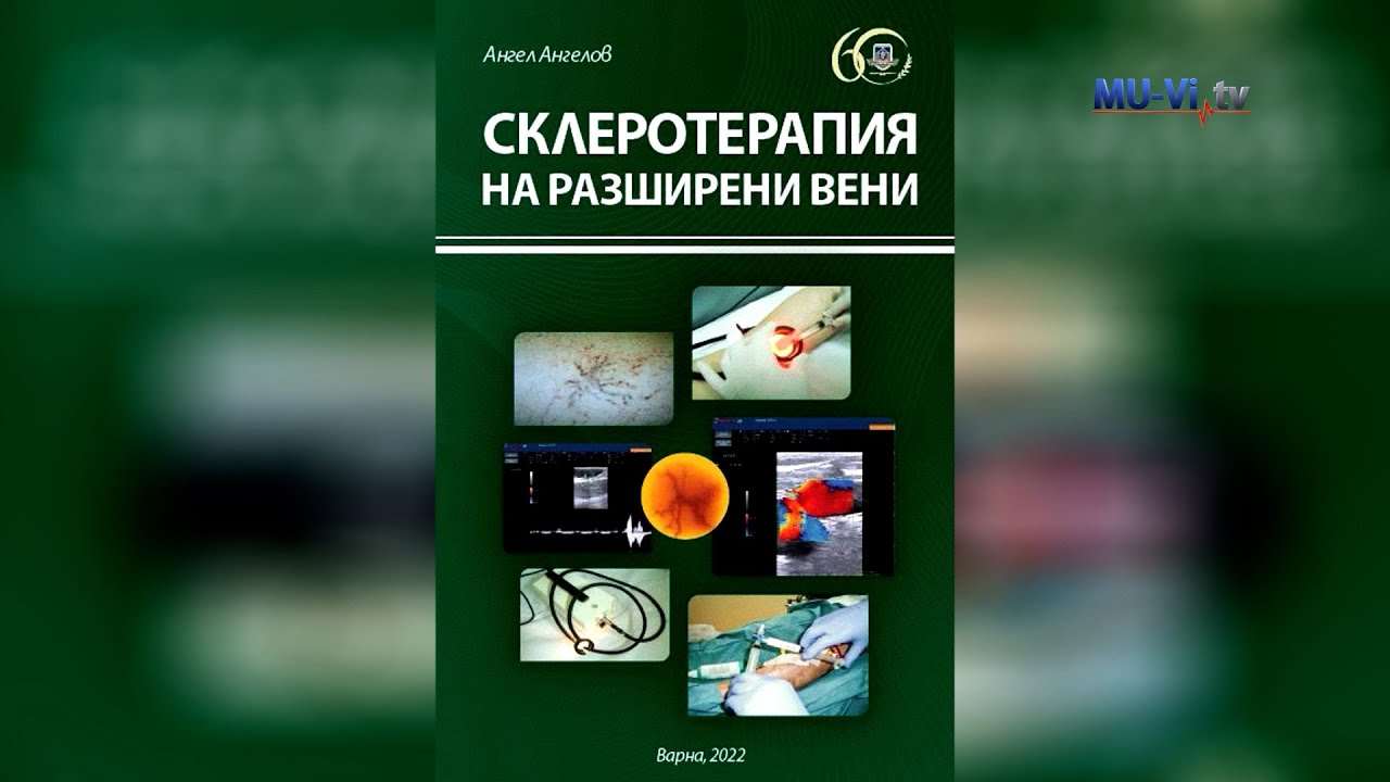 Склеротерапия на разширени вени