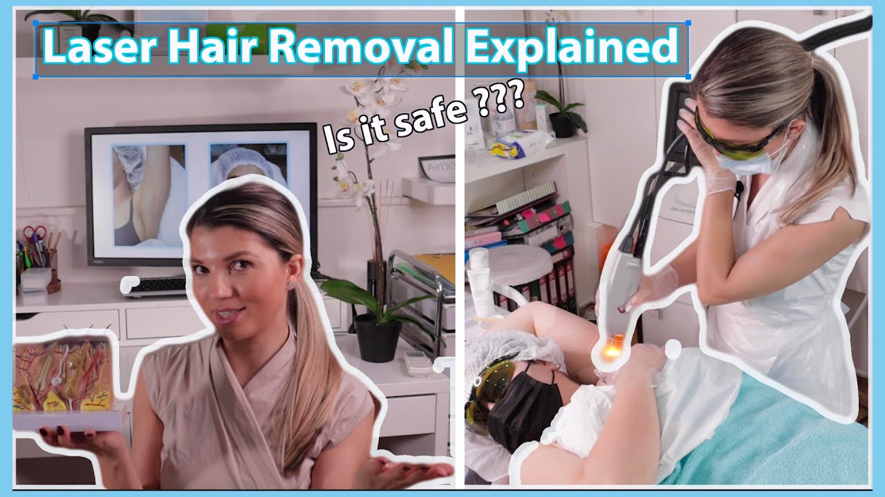 Laser Hair Removal process fully explained - Full Demo on Underarms using Candela Laser (2020)