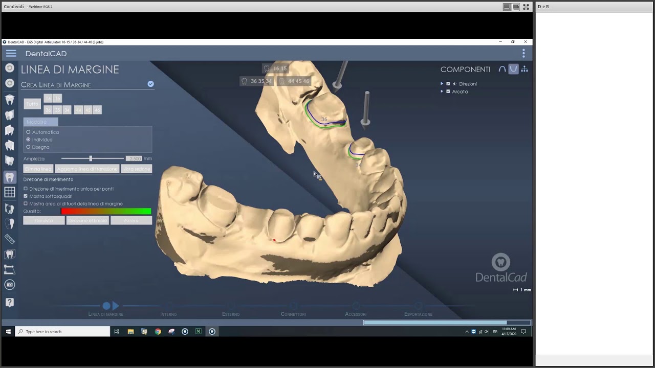 Live Webinar - 17 Aprile 2020 - DentalCad Articolatore Digitale