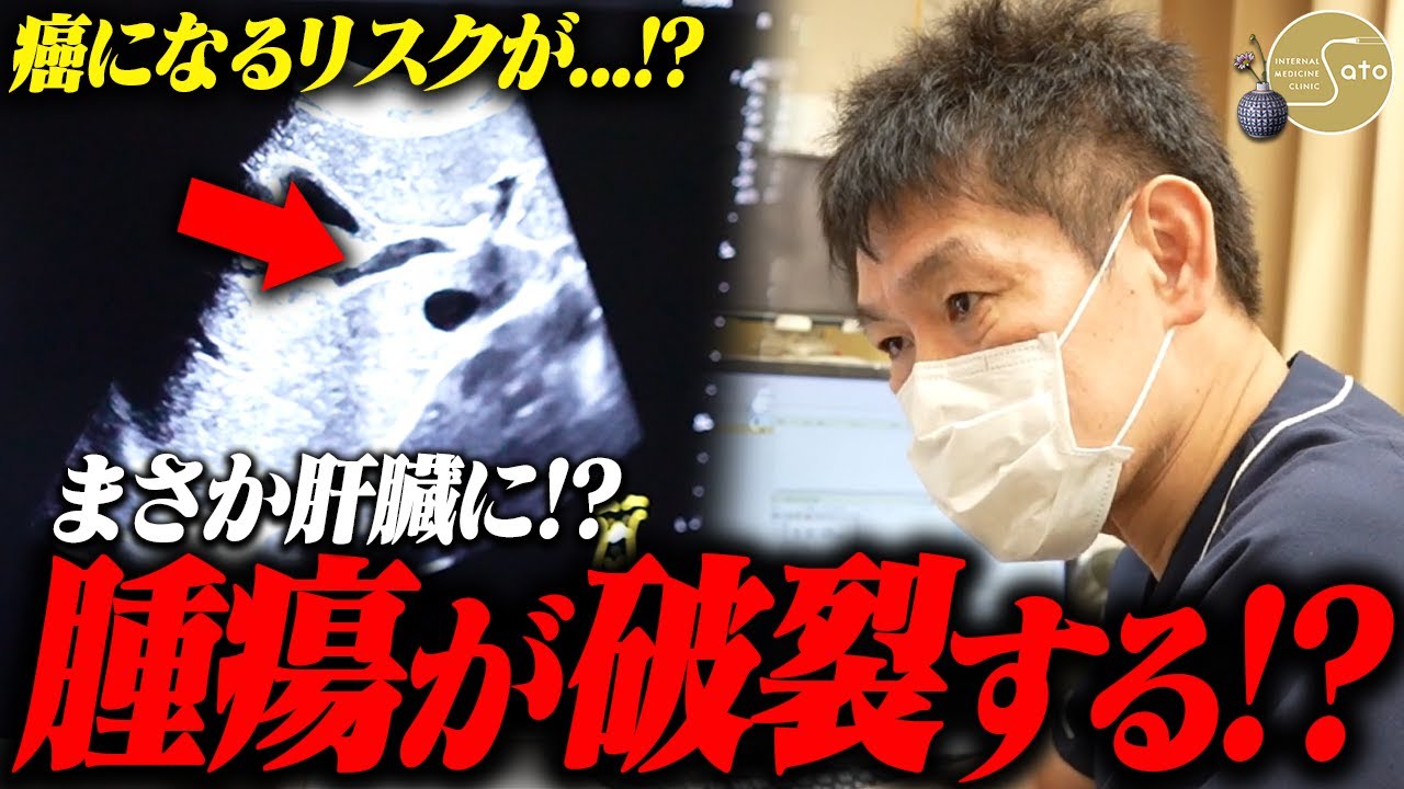 『肝臓に腫瘍発覚！？破裂の危険！？』健康診断の再検査で来院した患者... エコー検査でまさかの結果が！？