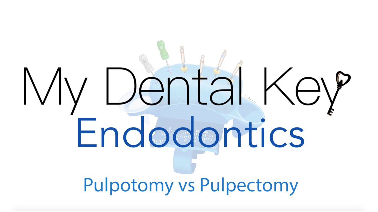 Pulpotomia kontra pulpektomia | My Dental Key