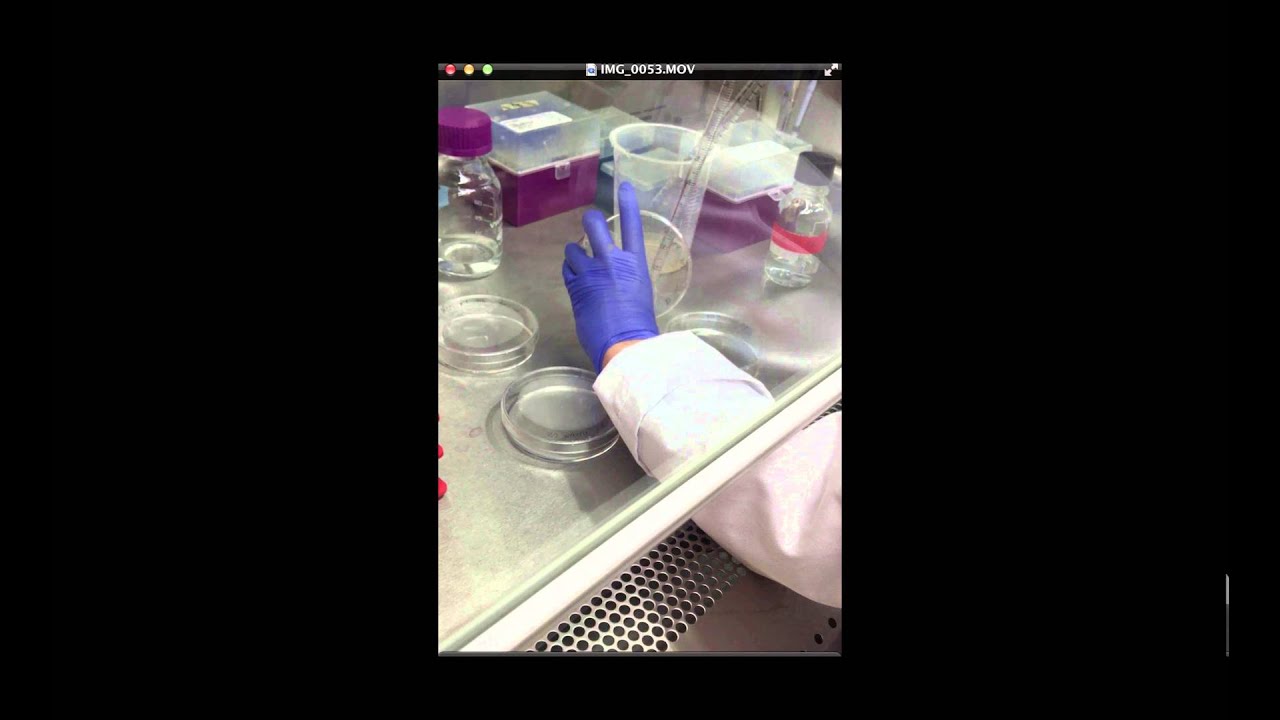 In vitro chondrogenic differentiation of mesenchymal stem cells in alginate scaffolds