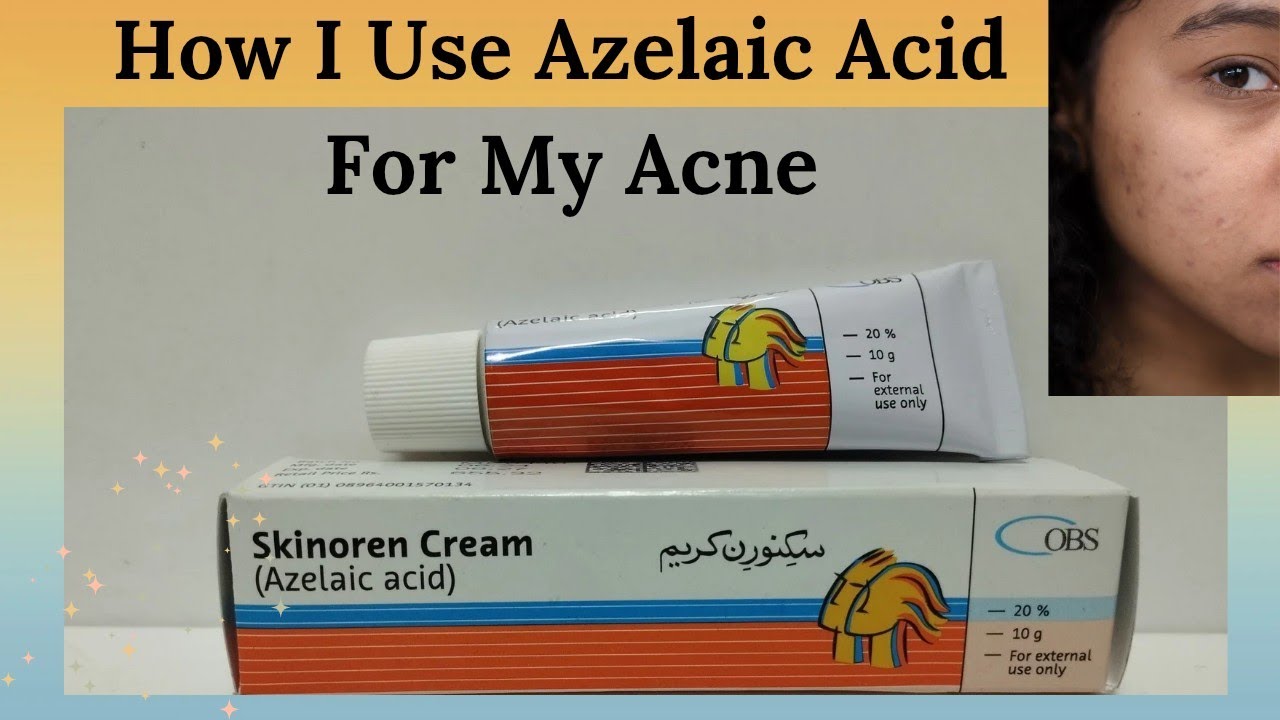 How I use Azelaic Acid For My Acne | How To Use Skinoren Cream