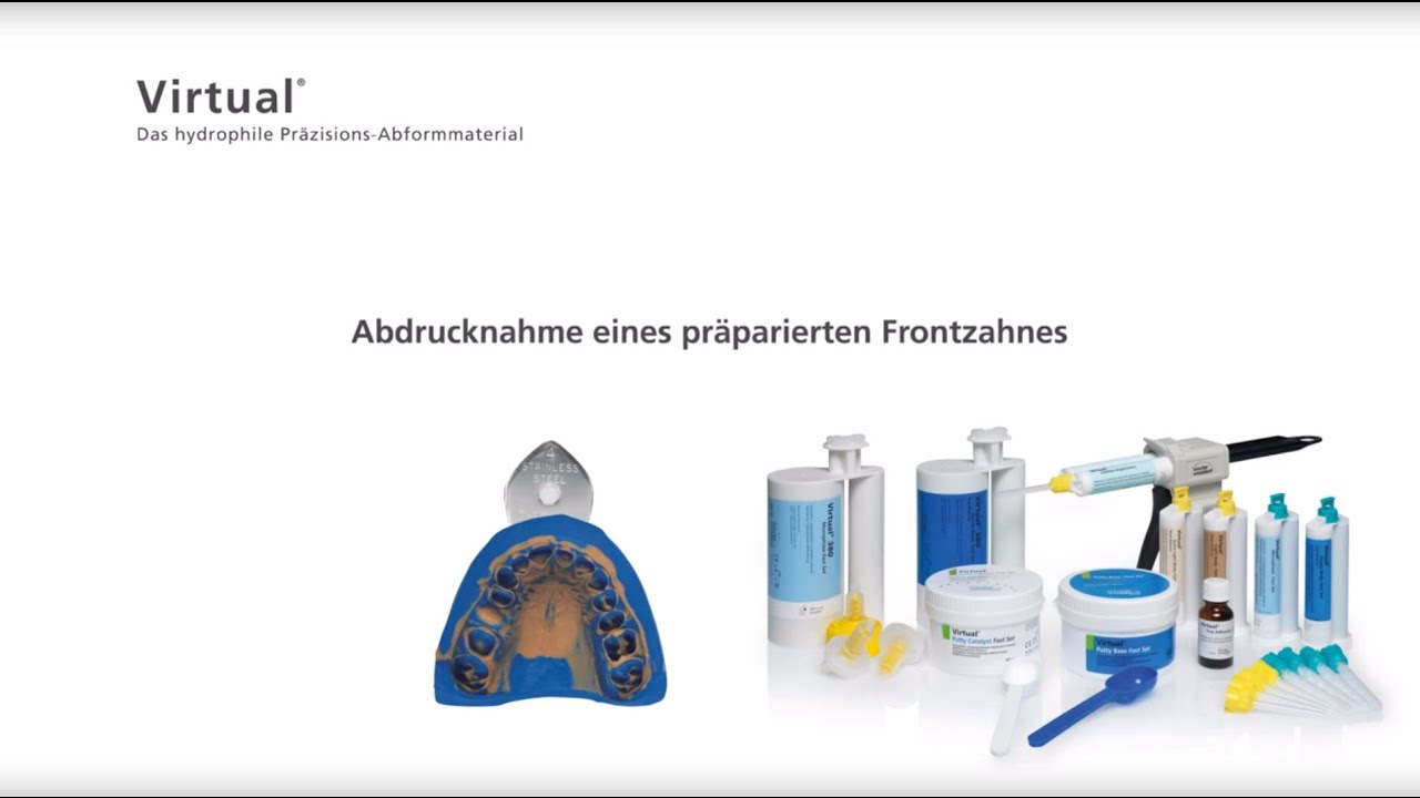 Virtual - Abformung eines pr&auml;parierten Frontzahnes