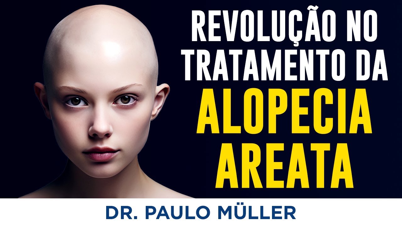 Revolução no Tratamento da Alopecia Areata – Dr. Paulo Muller Dermatologista.