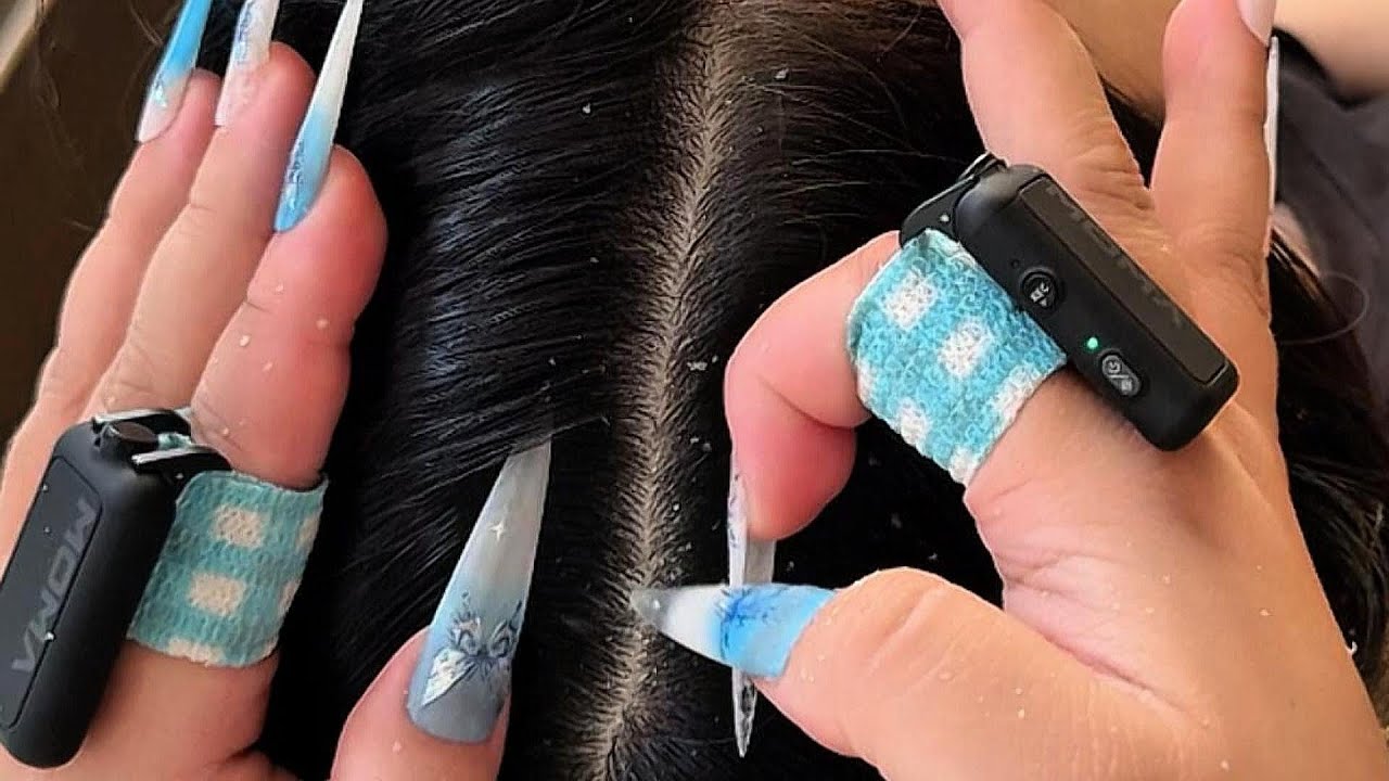 Satisfying Scalp Cleaning | ASMR Dandruff Removal with Nails