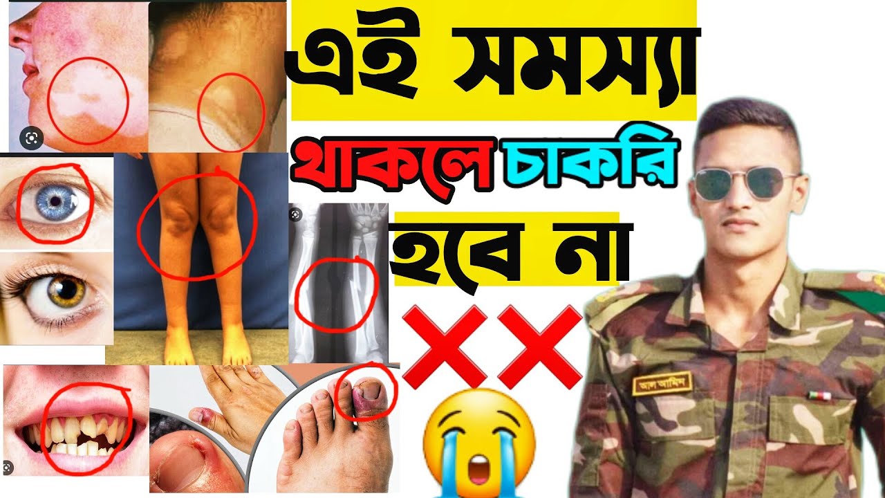 কি কি সমস্যা থাকলে বাংলাদেশ সেনাবাহিনীতে  চাকরি হয় না। কি কি রোগ থাকলে আর্মি চাকরি হয় না। Bd army